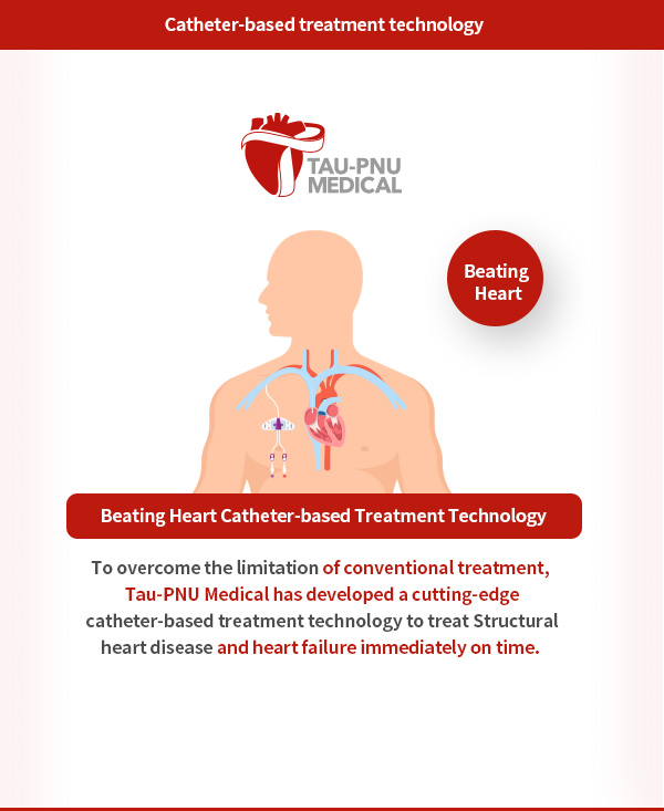 타우피엔유메디칼의 비개흉 카테터 기반 치료기술